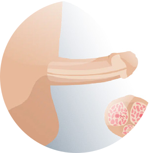 cirugia estetica masculina thumb